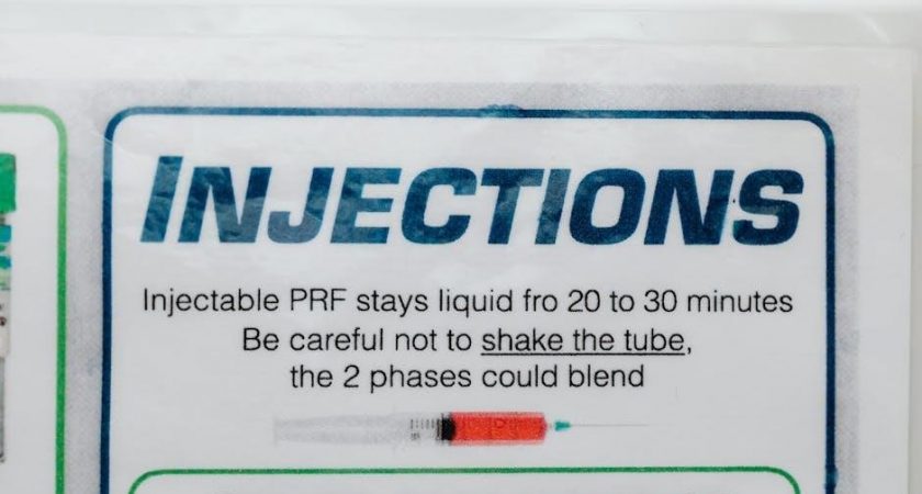 post op instructions for fluoride varnish